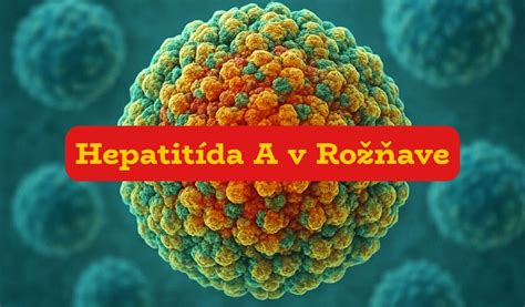 Ilustrácia trasúcich sa rúk.