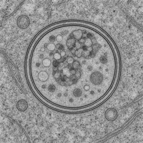 Mikroskopický pohľad na poškodené DNA