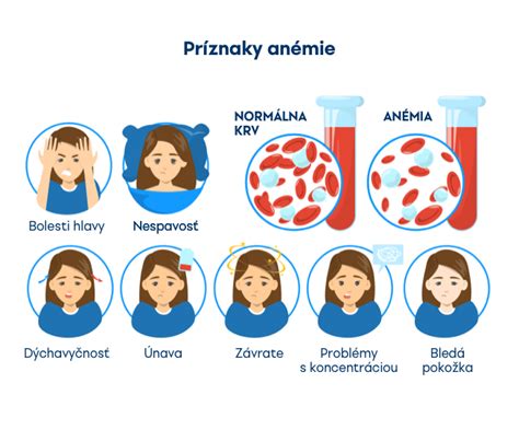 Infografika znázorňujúca príznaky anémie