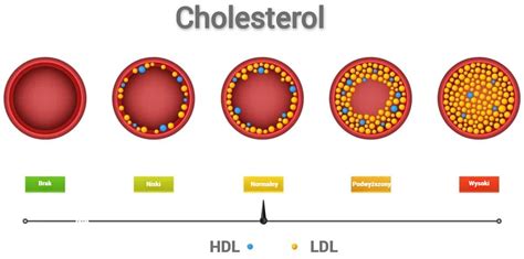 Molekulárna štruktúra HDL a LDL cholesterolu