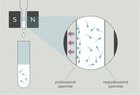 Poškodenie DNA v spermiách