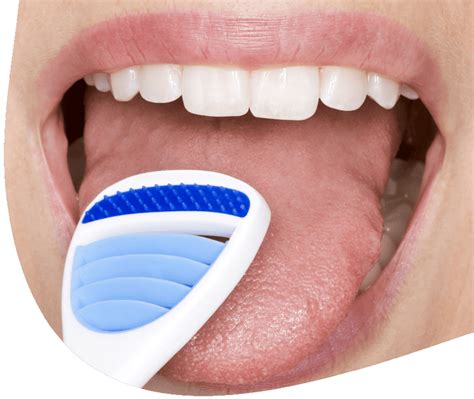 Jazyk s bielym povlakom