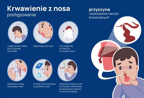 Infografika zobrazujúca bežné príčiny krvácania z nosa