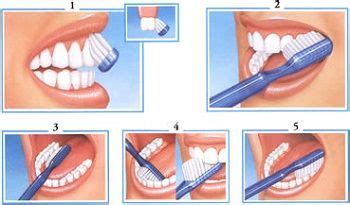 Obrázok s balením preháňadla na čistenie čreva