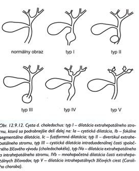 Anatómia žlčníka a žlčových ciest