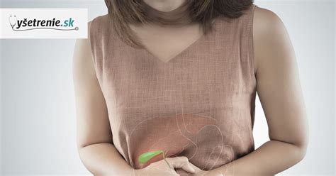 Ilustrácia žlčníkových kameňov