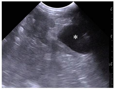 Ilustrácia funkcie alkoholmetra a hydrometra