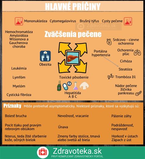 Infografika zobrazujúca príznaky kocoviny a ich príčiny