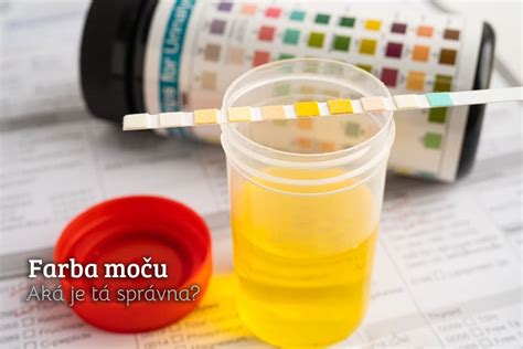 Ilustrácia alkoholového testu z moču v kazete