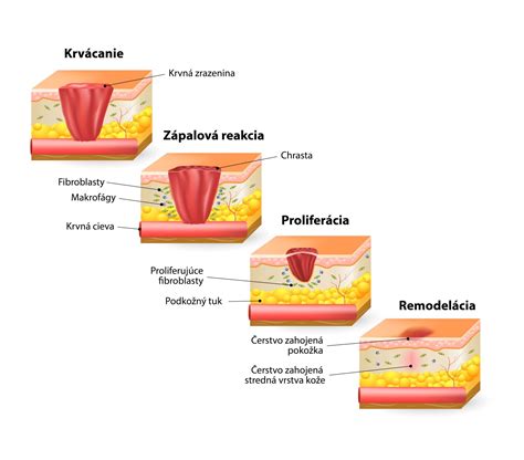 Reakcia aldehydu so Schiffovým činidlom