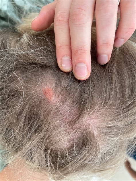 osoba s nalepenou náplasťou na hlave