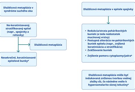 Diagram zobrazujúci proces filtrácie vodky