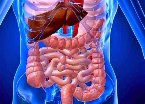 Ilustrácia ľudského tráviaceho traktu s vyznačením možných miest postihnutia Crohnovej choroby