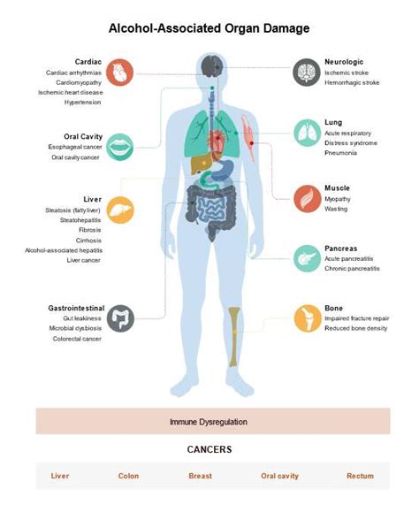 Infografika zobrazujúca poškodenie orgánov v dôsledku užívania alkoholu