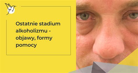 Ilustrácia znázorňujúca rôzne formy liečby alkoholizmu