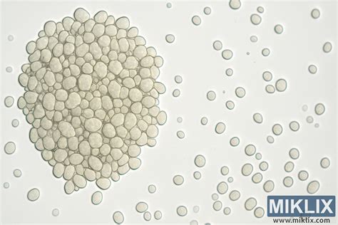 Mikroskopický pohľad na štruktúru zinkového povlaku