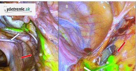 Ilustrácia znázorňujúca rôzne terapeutické metódy používané pri liečbe závislostí
