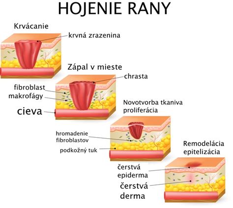 Diagram ukazujúci proces hojenia rany po extrakcii zuba