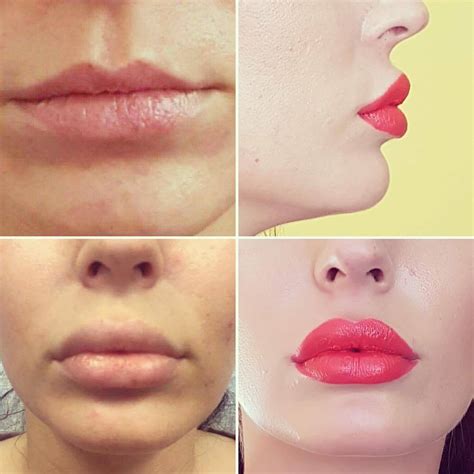 Krásne a plné pery