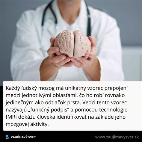 Ilustrácia ľudského mozgu s rôznymi oblasťami označenými