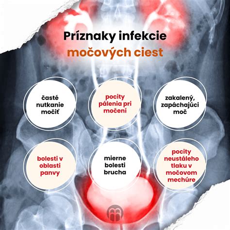 Anatomická schéma ľudských močových ciest