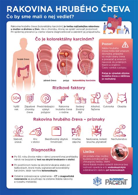 Infografika znázorňujúca príznaky krvácania z horného tráviaceho traktu