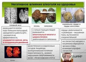 Infografika znázorňujúca štruktúru mozgovej cievy a vplyv alkoholu na jej steny