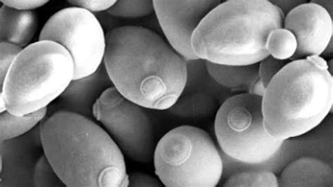 Mikroskopický pohľad na kvasinky Saccharomyces cerevisiae