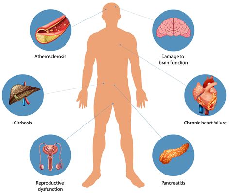 Ilustrácia znázorňujúca vplyv alkoholu na rôzne orgány