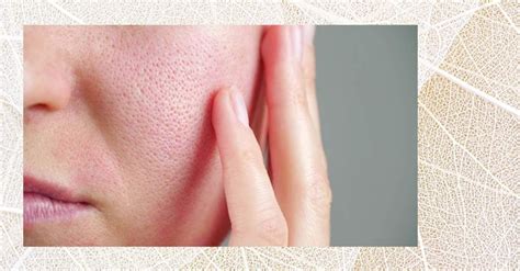 poškodená pokožka tváre v dôsledku alkoholu