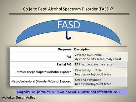 Porovnanie tváre dieťaťa s FAS a bez FAS