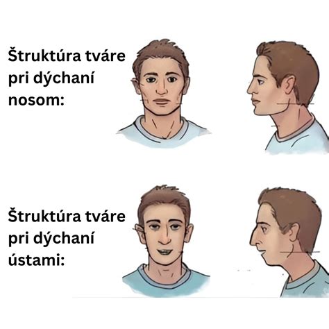 Infografika zobrazujúca štrukturálne zmeny tváre pri FAS