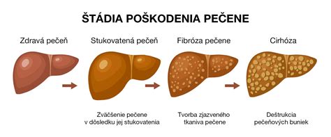 Infografika zobrazujúca proces regenerácie pečene