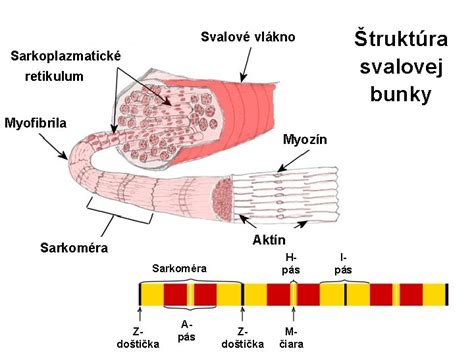 Ilustrácia poškodeného nervového vlákna