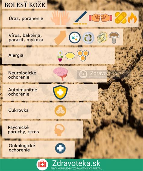 Infografika zobrazujúca rôzne príčiny bolesti hrdla, vrátane vírusov, baktérií, alergií a environmentálnych faktorov