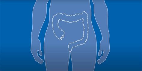 Ilustrácia procesu odkaľovania muštu