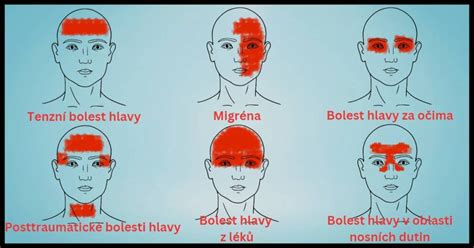 Infografika s tipmi na prevenciu bolesti hlavy po alkohole